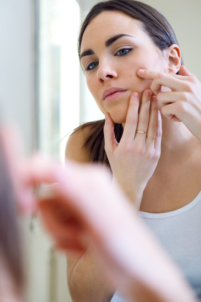 eliminar el acne definitivamente